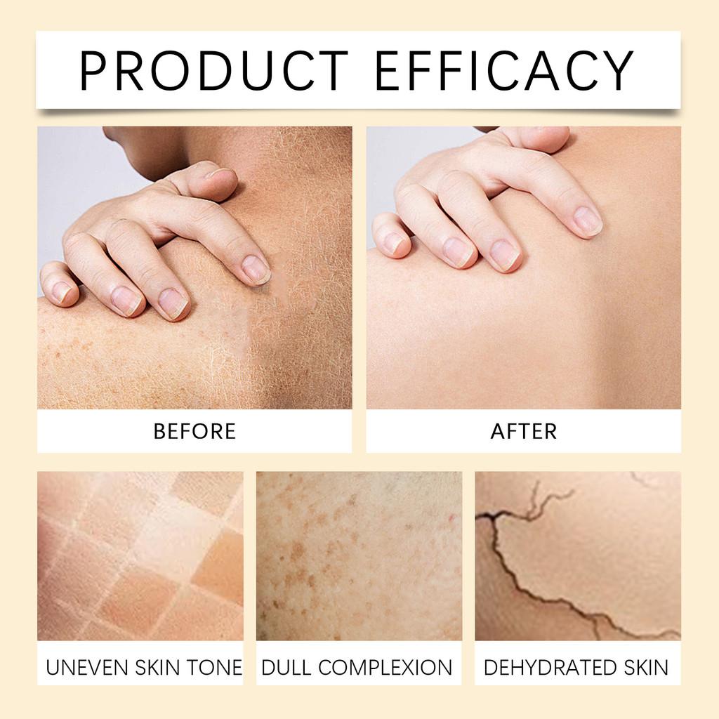 Ouhoe Natural Turmeric Body Scrub Gentle Exfoliating Formula For Smooth Radiant Skin