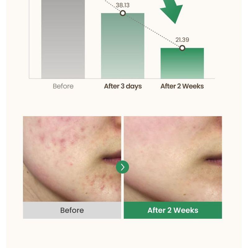 AXIS - Y - Dark Spot Correcting Glow Serum