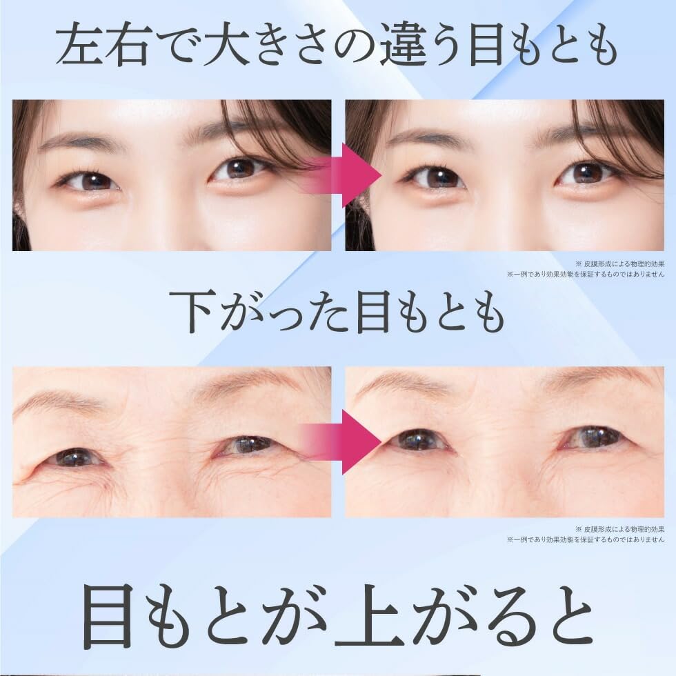 Medicated Wrinkle Gel 10ml for Eye Area Wrinkle and Lifting for Dark Fine and Fine Eye Cream for Feet and Dry [Quasi-drug] Improvement, Whitening,