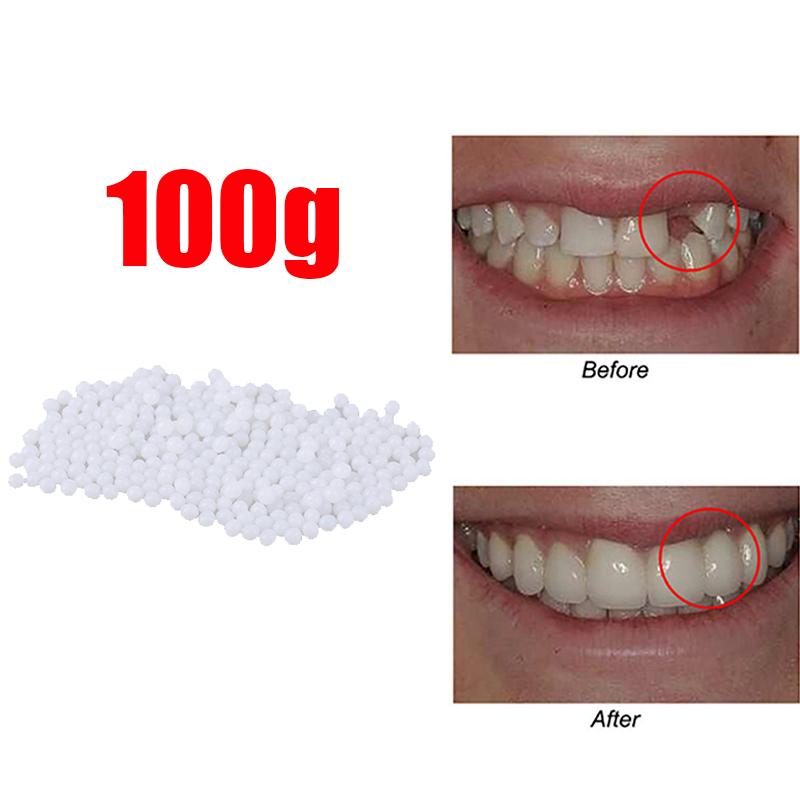 10g-100/bag Tooth Repair Kit-thermal Beads For Filling Fix The Missing And Broken Tooth Or Adhesive The Denture Fake Teeth Gutta