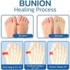 New Thin Anti Slip Mesh Projoint Antibunions Health Sock Five Finger Socks Women's Split Toe Socks