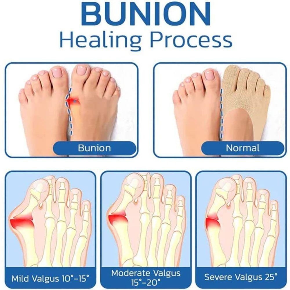 New Thin Anti Slip Mesh Projoint Antibunions Health Sock Five Finger Socks Women's Split Toe Socks
