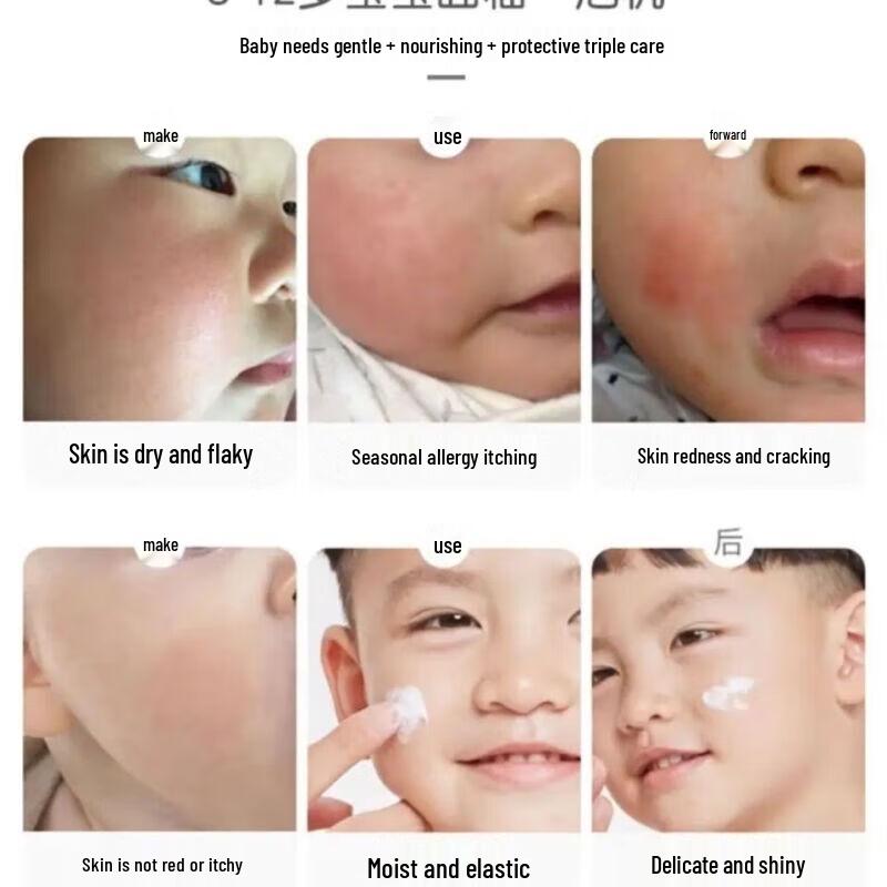 Frog Prince Honey Baby & Kids Moisturizing Face Cream