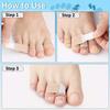 5/10/20 Pcs Hammer Toe Straightener Toe Splints Cushions Bandages For Correcting Crooked & Overlapping Toes Protector, Foot Care Tool