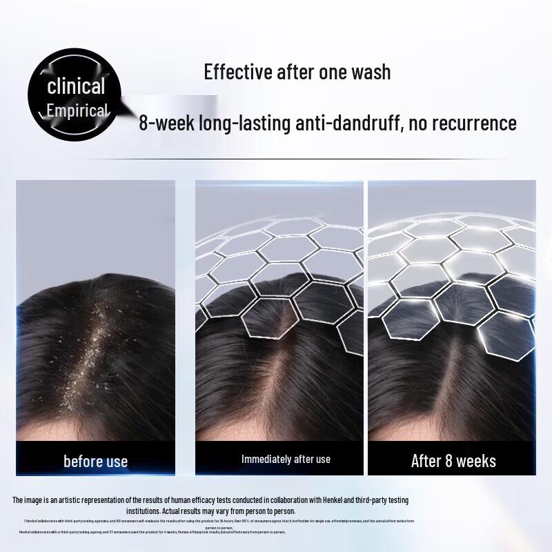 Schwarzkopf Anti-Dandruff Conditioning Shampoo Set