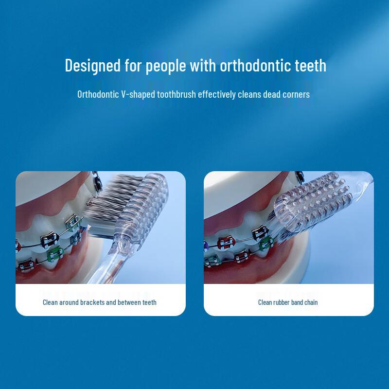 Frog Platinum Medical V-Shaped Soft Bristle Toothbrush D1 Edition