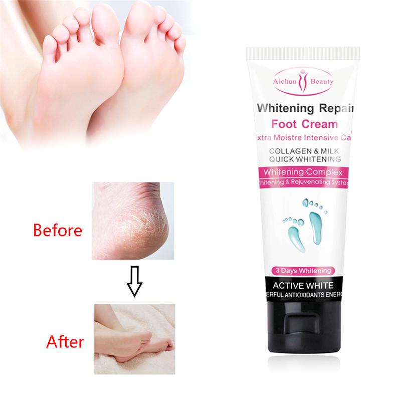 feet moisturizing cream