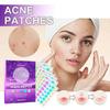 Jaysuing Acne Patches For Diminishing Facial Acne And Blemishes With Pore Care 180 Pcs
