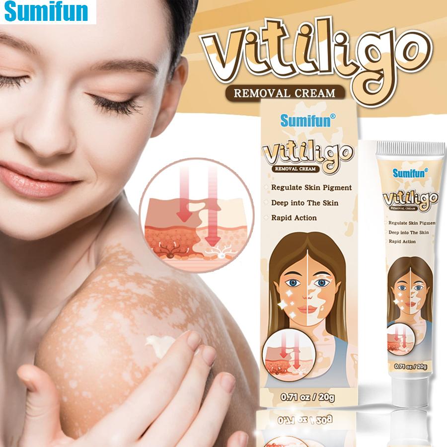 

Sumifun 20/40/100ML Reduce Spots Cream Natural Herbal Relief Skin Care Ointment,Clean Face Body Spot Improve Skin Pigmentation 1PC(20 ML)