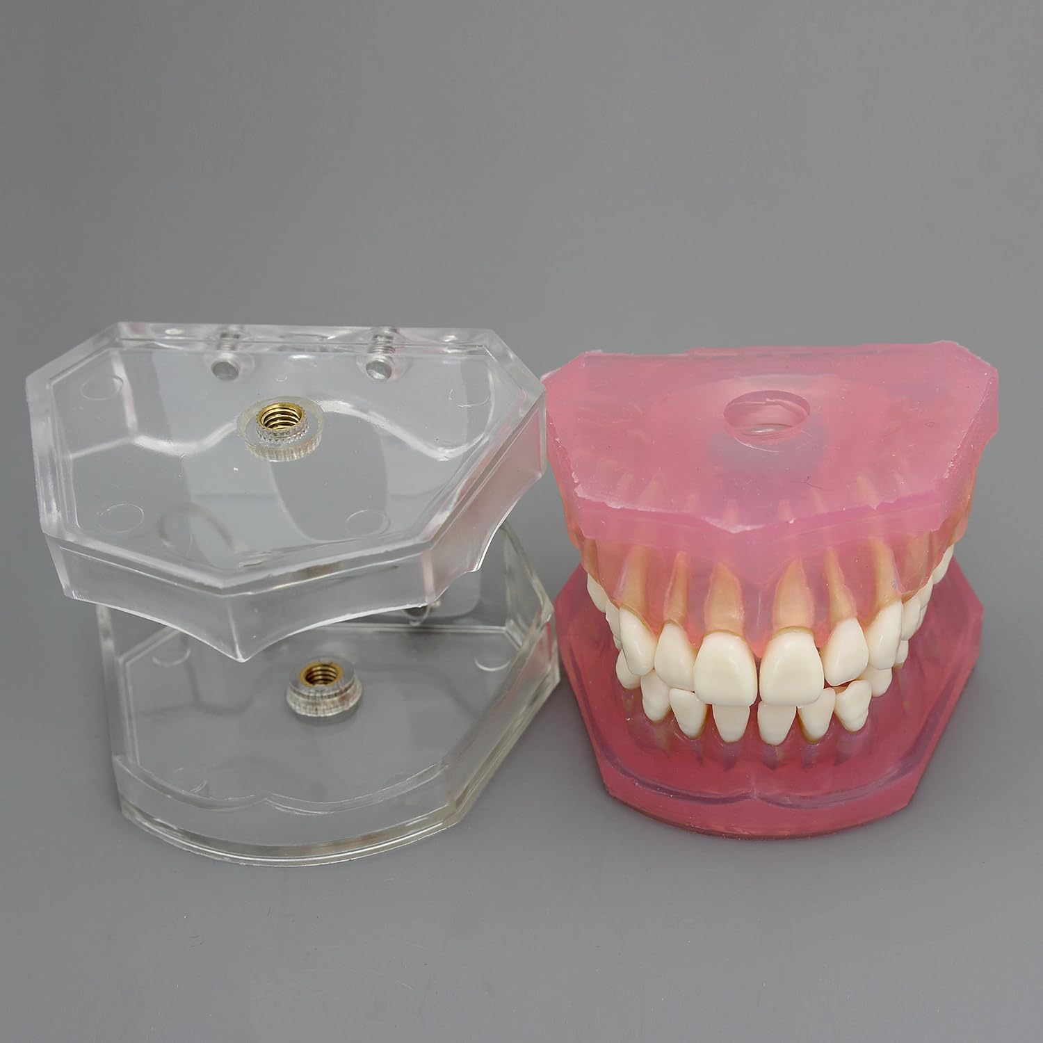 Dental Implant Teeth Model with Removable Teeth for Dental Professionals and Students