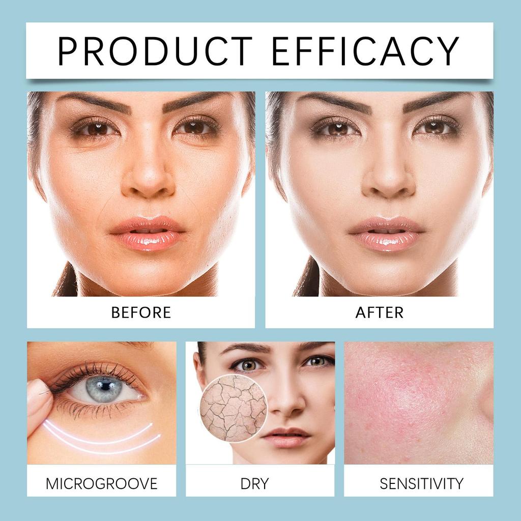 West&Month Facial Nourishing Moisturizing Cream, Gently Moisturizes and Repairs Dry Skin, Hydrates and Moisturizes, Suitable for the Face, 30g