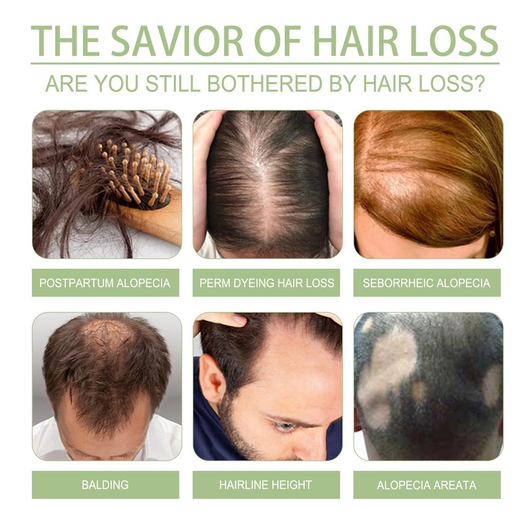 Sanftes, pflegendes Kräuterhaaröl zur Stärkung der Kopfhaut, reinigt und pflegt das Haar und macht es geschmeidig.