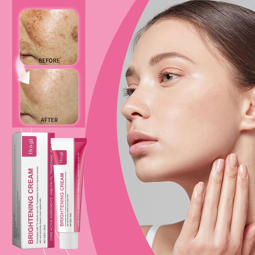 Arbutin Cream Whitening Freckle Cream Smooth Improves Dull Skin Deep Moisturizing Hydrating Face For For Sensitive Skin 202 X9Z6