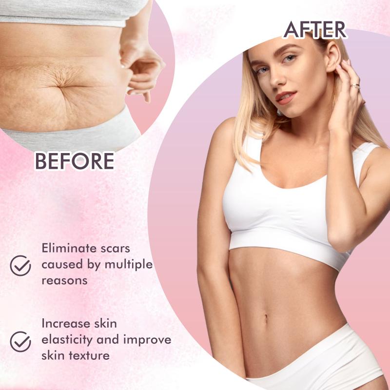 OceAura Nourishing Body Oil Fade Scars Stretch Marks Fine Lines Repair Moisturize Soften Smooth Body Skin