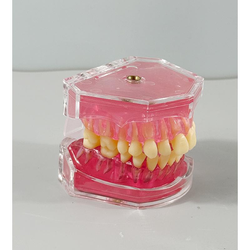 Прозора Знімна Повна Модель Щелепи з М'якими Яснами та Зубами для Підготовки до Імплантації