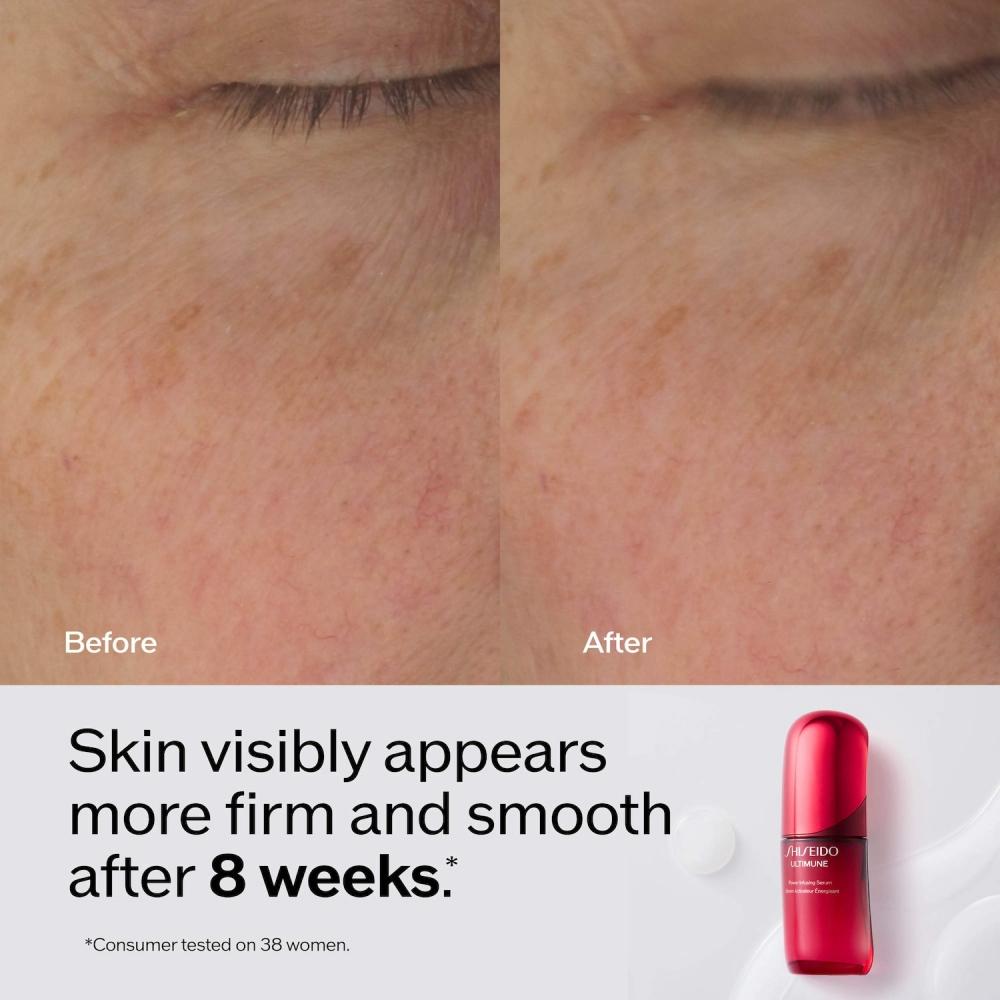 Shiseido Ultimune Power Infusing Serum 2.5 Oz For Radiance   Wrinkles