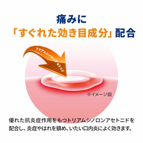 [Designated Category 2 OTC drug] Aphthaguard 5g