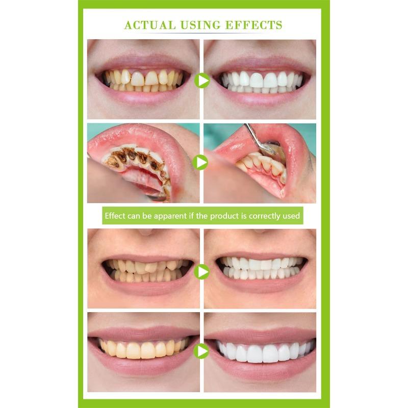 Teeth Brightening Tooth Cleaning Liquid to Remove Tooth Stains, Smoke Stains, Tartar, Oral Cleaning
