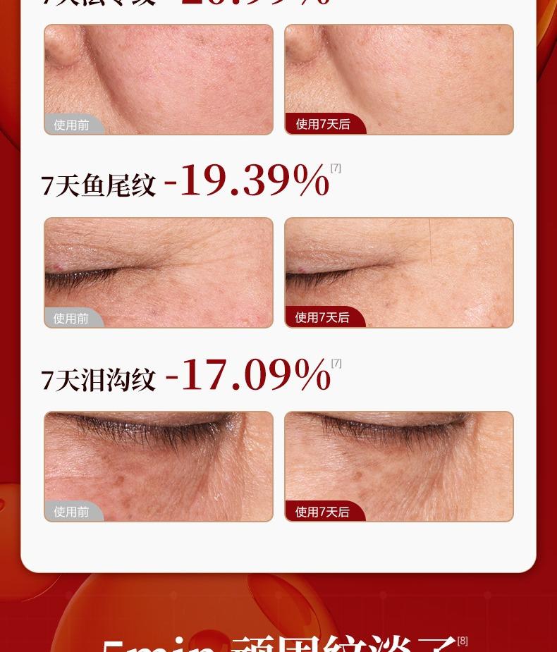Yunifang Black Ginseng Wrinkle Resistant + Whitening & Spot Removing Essence Multi-Combination Package