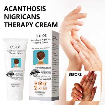 Spot Remover For Body,Spot Corrector Cream,- Underarm, Neck, Armpit, Knees, Elbows, Private Areas, Intimate Areas