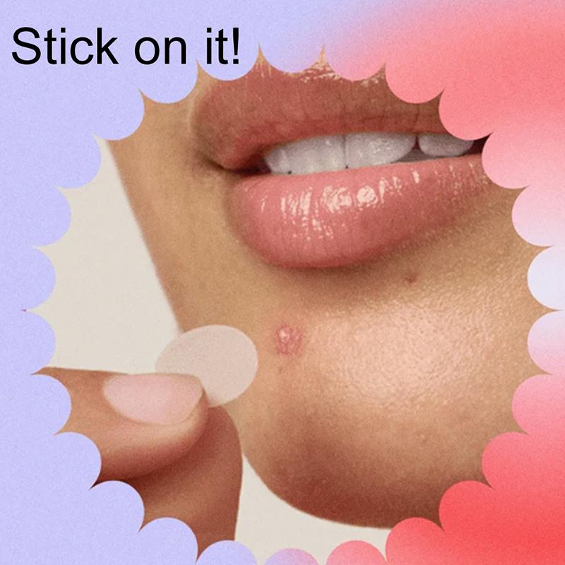 360 Unidades Parche para Ampollas Bucales Parche para Calenturas Labiales Parche para Ampollas Labiales Curación de Calenturas Hidrocoloide Pegatinas para el Cuidado de los Labios Parche para Ampollas Bucales