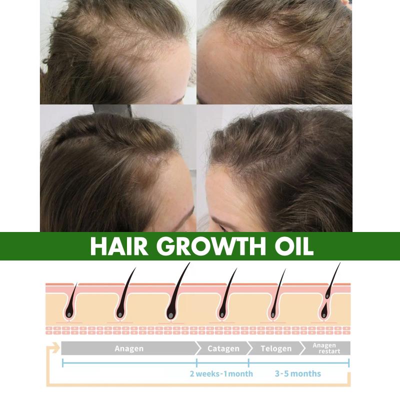 Eelhoe Hair Conditioner Moisturizes Hair Strengthens Hair Protects Hair From Damage Makes Hair Fluffy And Smooth