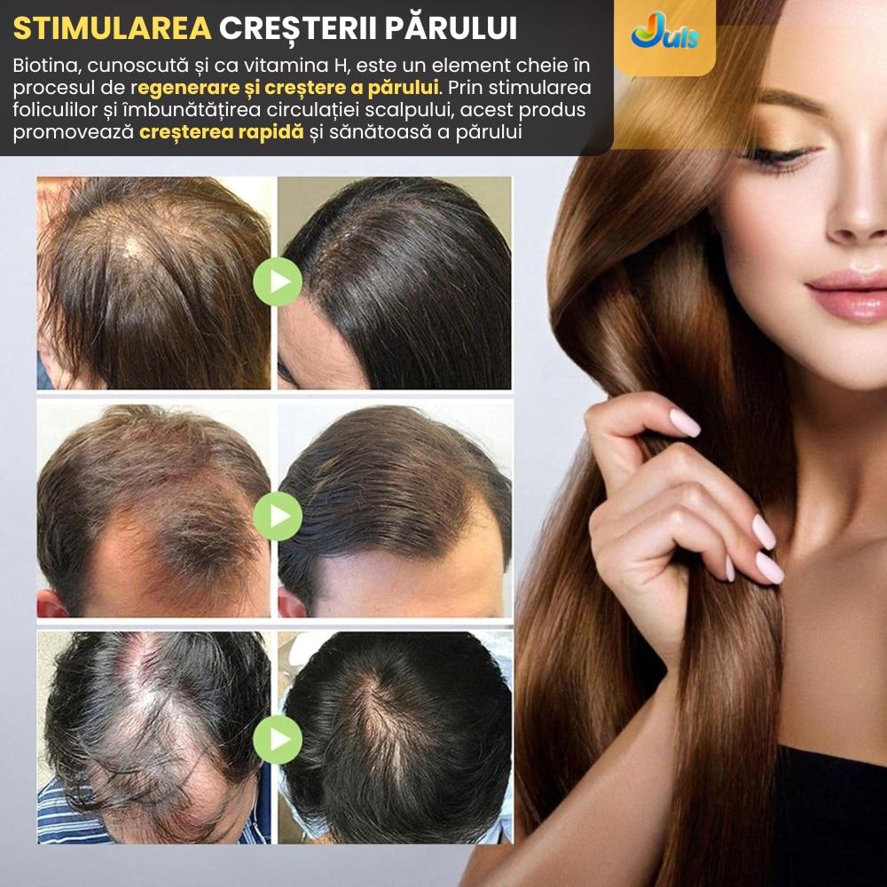 4 bottles of hair serum, advanced fast growth treatment, strengthens hair, prevents hair loss, moisturizes brittle hair, repairs hair ends