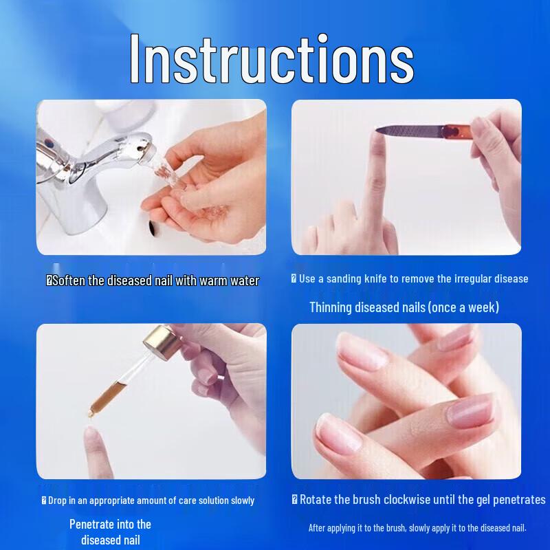 Tongrentang Nail Fungus Repair Treatment