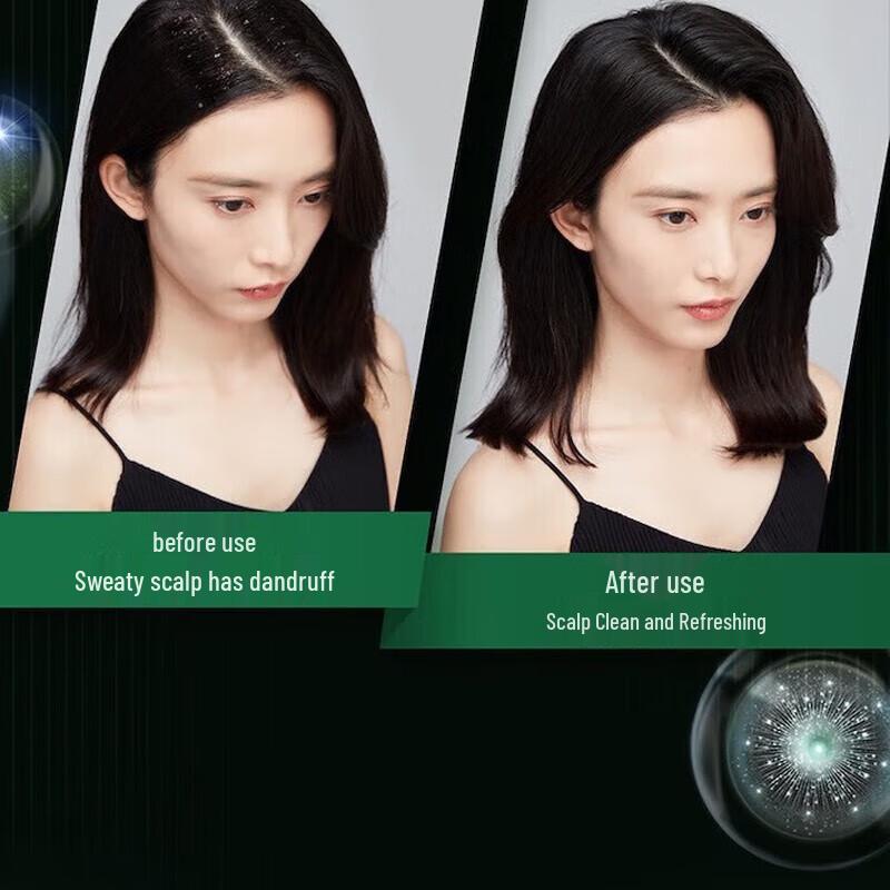 Clear Icy Mint Anti-Dandruff Shampoo 2 X 175g