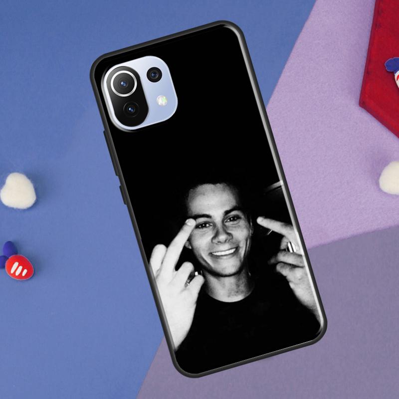 Dylan O'Brien Teen Wolf Cover For Xiaomi 14 Ultra 13 11T 12T 13T 14T Pro POCO X6 X7 Pro X3 X5 F3 F5 F6 M6 Pro Case