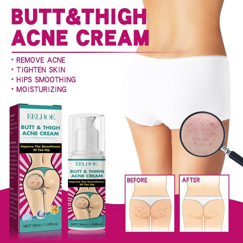 Eelhoe Luxurious Hydrating Body Moisturizer Cream For Deep Nourishing Skin Care