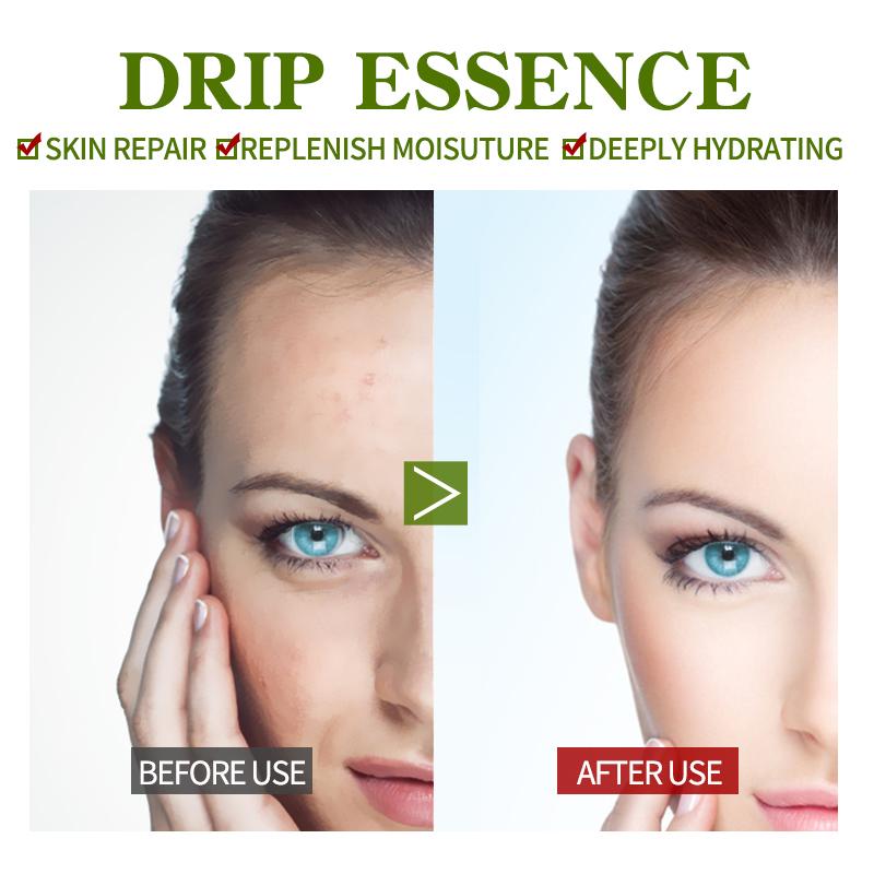 

Продукт по уходу за кожей, сыворотка для лица с ниацинамидом 24 карата, антивозрастная гиалуроновая кислота для лица, сужает поры, корейские средства по уходу за кожей