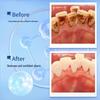 Dr. Ya Stain Removal Toothpaste