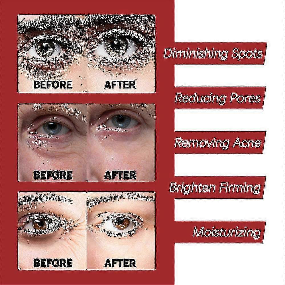 Retinol Collagen Complex Day &amp; Night Cream Anti-aging Formula +ha Hyaluronic Acid 30g, 1pc