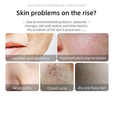 4-in-1 Facial Beauty Device LED Red Light Therapy Face Skincare Wand Microcurrent Facial Eye