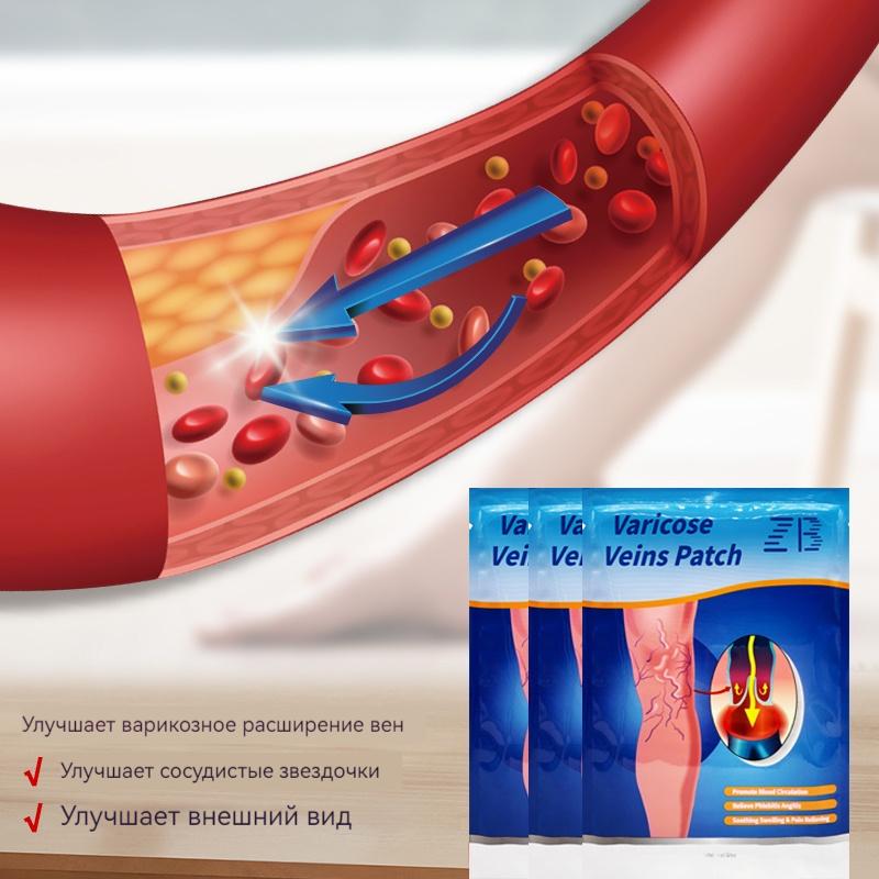 Varicose Veins Ease Plaster Chinese Herbal Patch For Veins To Enhance Capillary Health Care