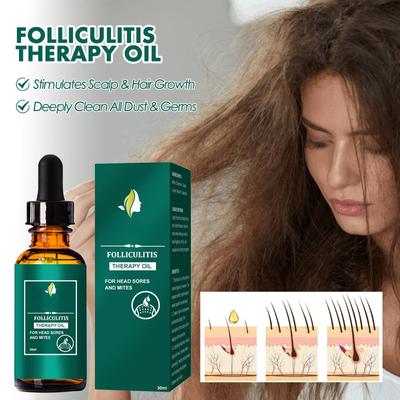 30ml Scalp Hair Care  Refined Oil, Scalp Deep Cleansing And Repairing Scalp Skin Care  Refined Oil
