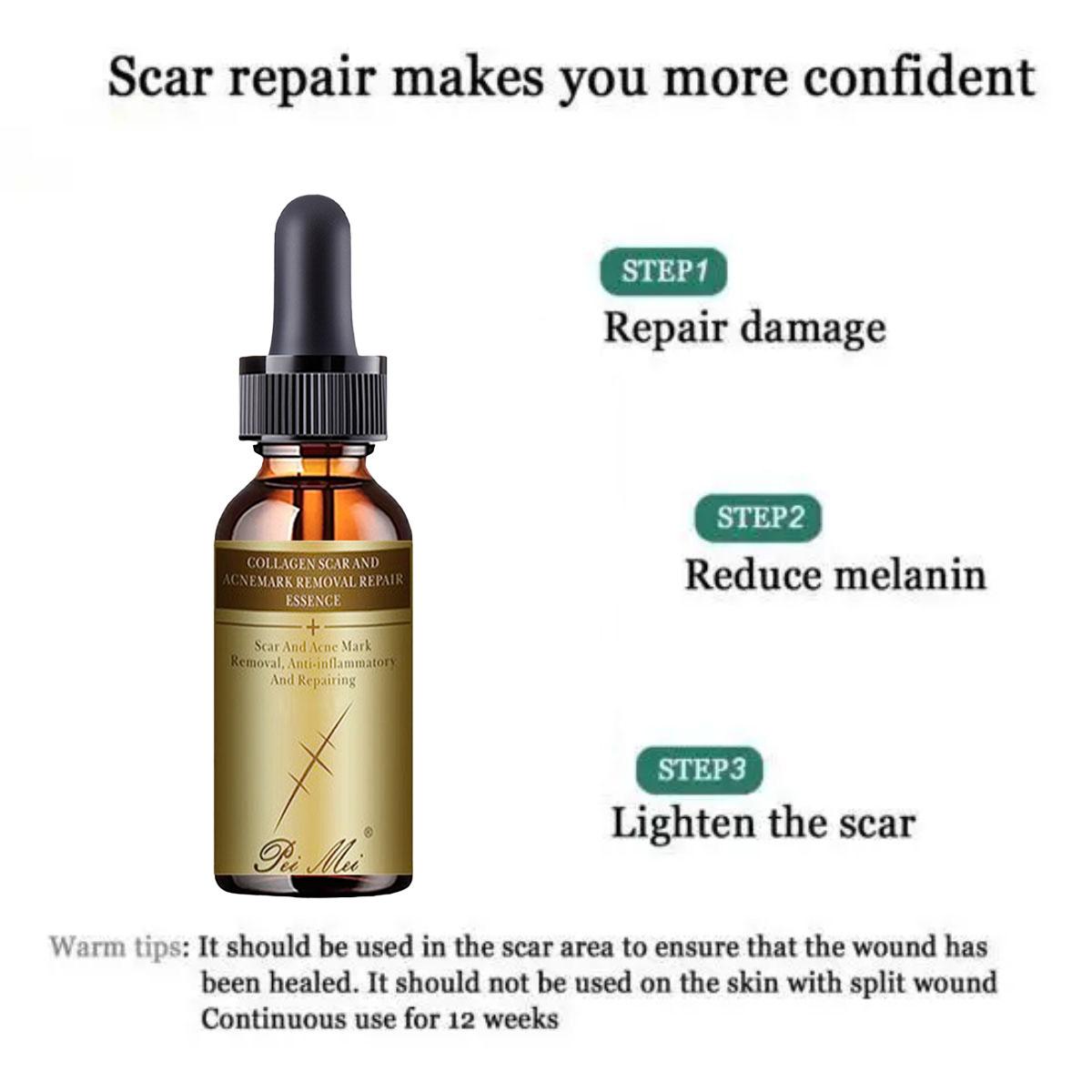 

Крем для беременных, восстановление кожи для беременных, крем для тела, крем для удаления растяжек, уход за шрамами, послеродовая сыворотка, кремы для гладкой кожи