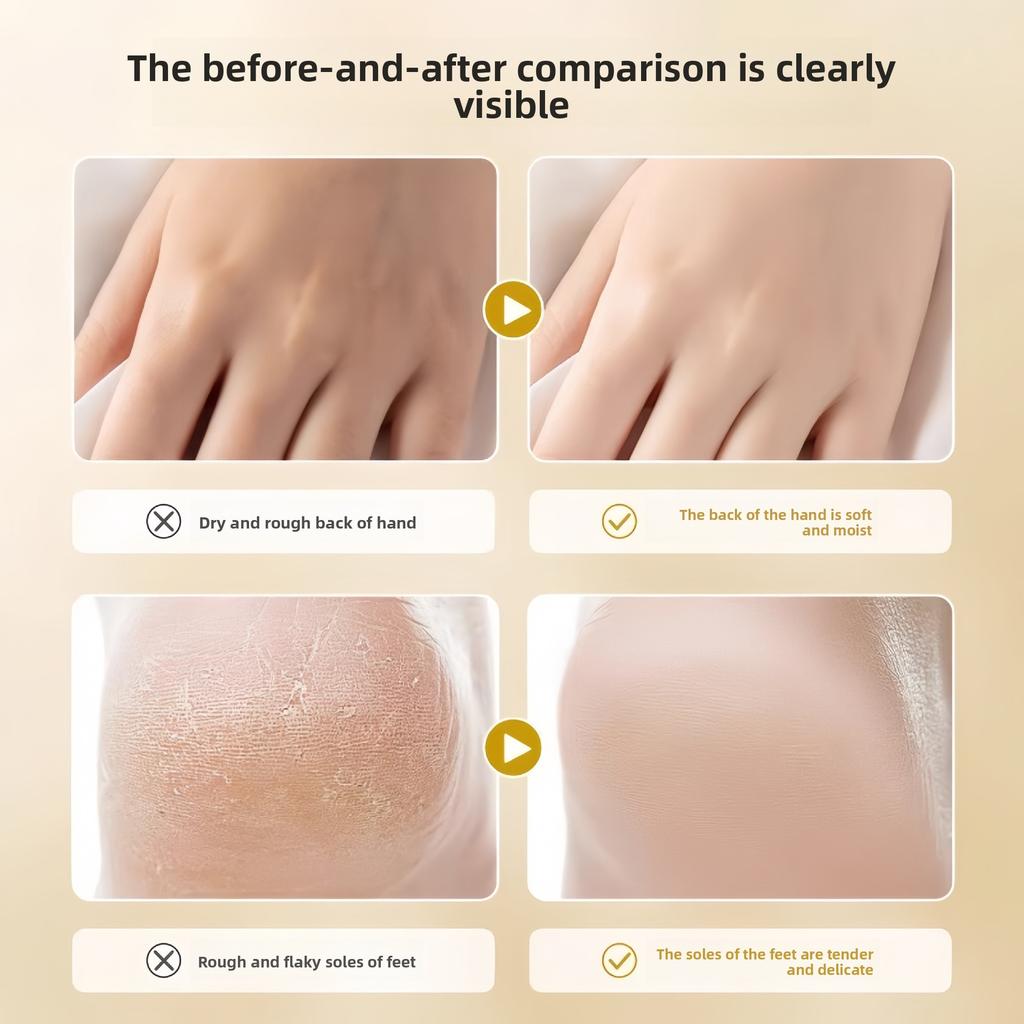 Moisturising Hand Cream for Crack Prevention and Dryness Relief