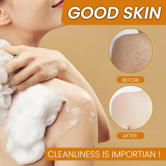 Kurkumové mýdlo na tmavé skvrny a akné na obličej a tělo, kurkumový exfoliační čisticí prostředek 100 g, kurkumové mýdlo pro všechny typy pleti