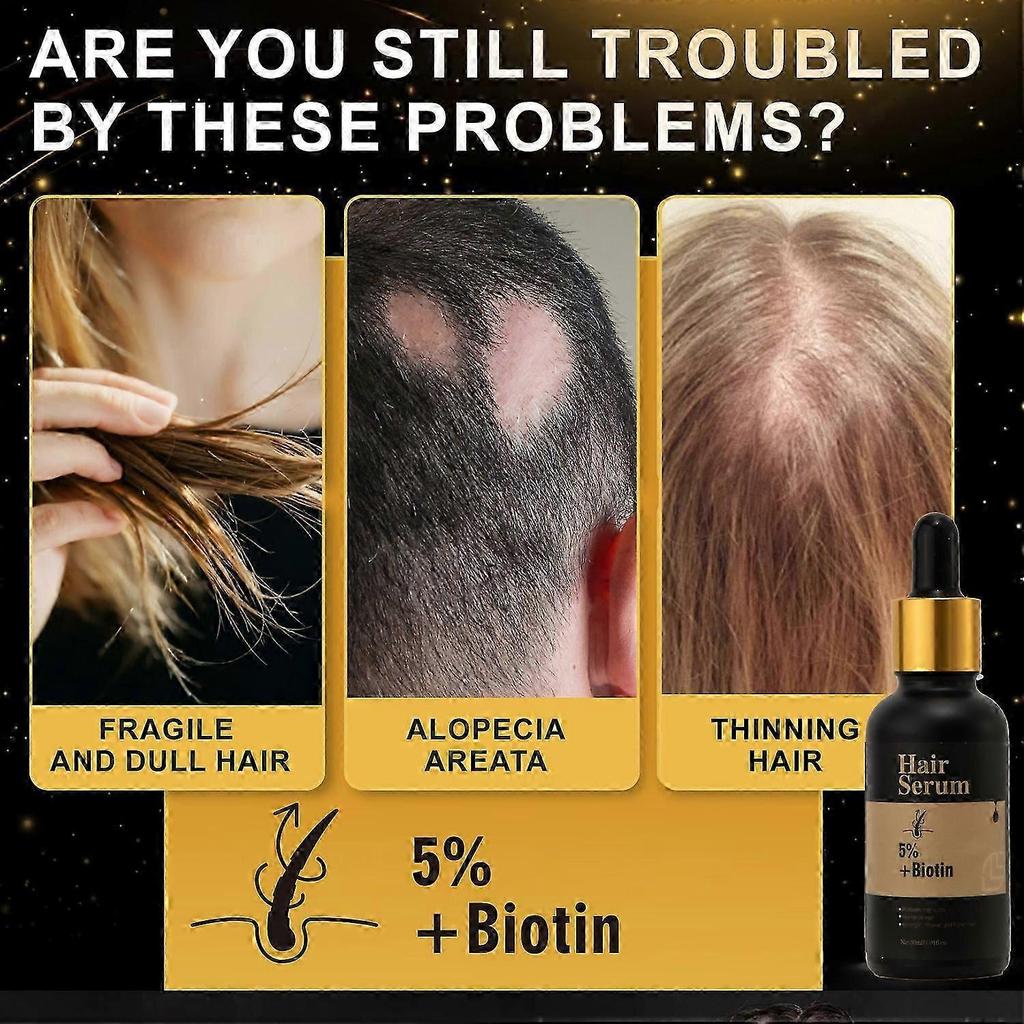 Hair Growth Serum with Biotin, Reduces Hair Loss, Nourishes Scalp & Strengthens Hair Follicles, Anti-Hair Fall Treatment for Men & Women, 60ml