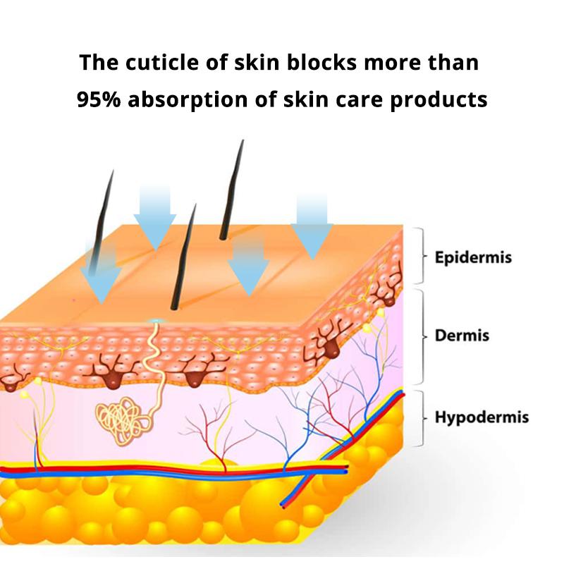 Schraubkartuschennadel-Ersatz für Auto-Derma-Micro-Pen-Platz-Nano-Nadel