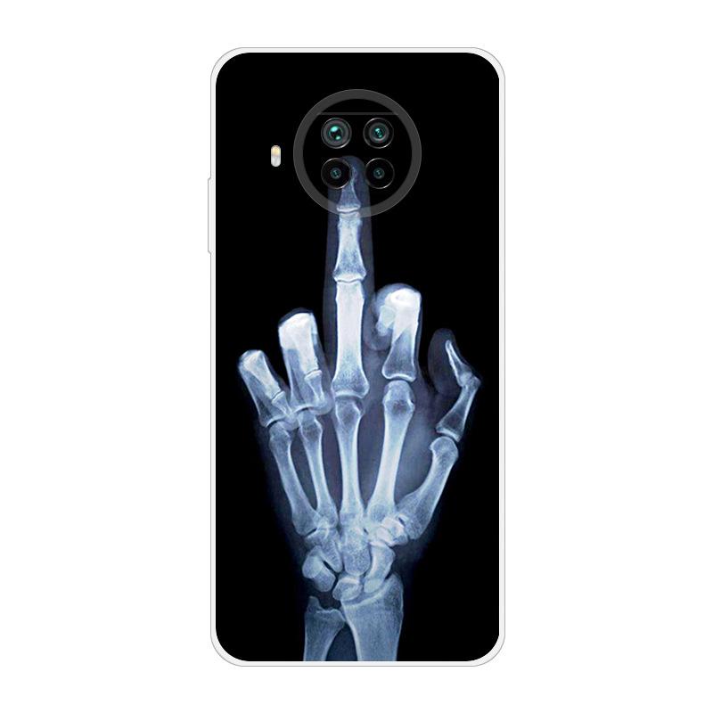 For Xiaomi Mi 10T Lite 5G Case Shockproof Soft silicone TPU Back Cover For Xiaomi Mi10T Lite 5G Phone Cases Mi 10 T Lite Coque