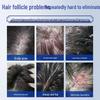 Jing Peitang Anti-Folliculitis Scalp Care Shampoo