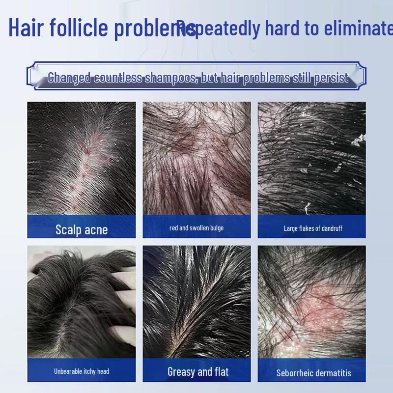 Jing Peitang Anti-Folliculitis Scalp Care Shampoo