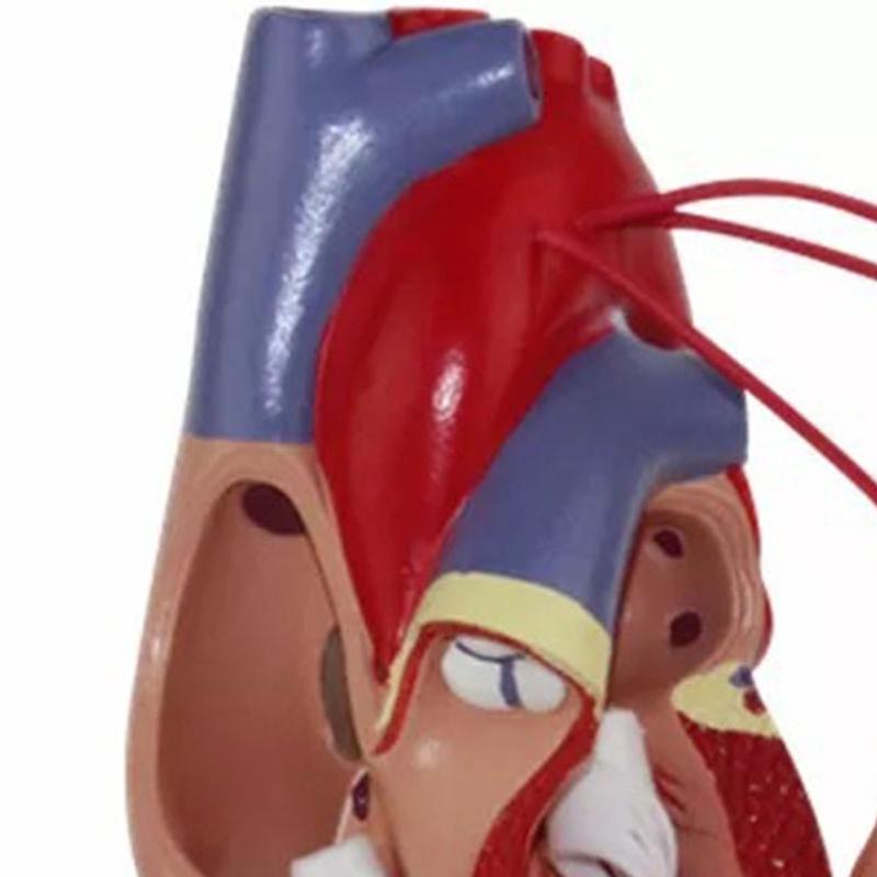 Modello Anatomico di Cuore Umano per Studio Cardiologico che Dimostra il Bypass Cardiaco