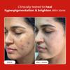 Conscious Chemist® Rapid Glow & Brightening Essence | Face Serum with 5 Antioxidant Complex (100X Stronger Than Vitamin C), Vitamin E & Retinol |
