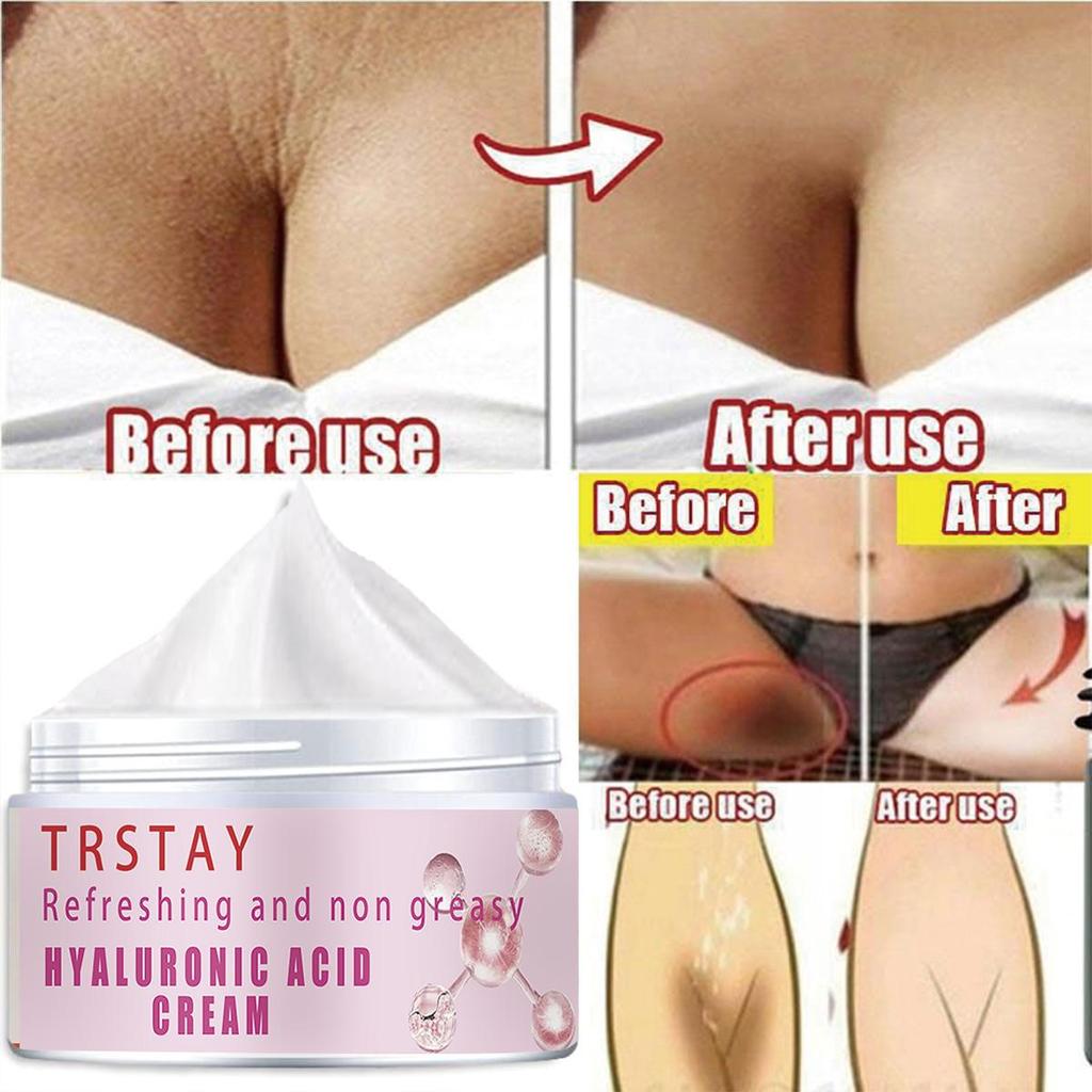 Whitening Cream, Removes , Eliminates Stubborn Spots, And Gives You A Fair And Tender Skin