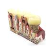 1 Pc Dental Teeth Common Pathologies Model Teaching Model Tooth Dentist for Medical Science Teaching Dental Communication Model