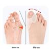 Silicone Bunion Big Toe Separator and Protector Cover